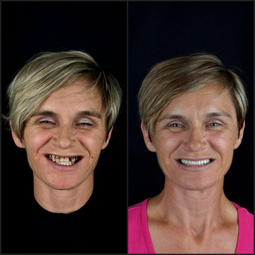 Slider image (7) A2 Dental: Premier Dental Clinic in Croatia